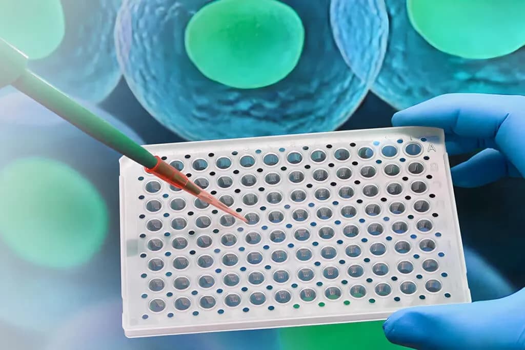 Protein Expression